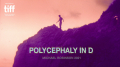Polycephaly in D